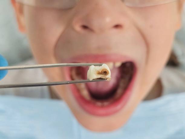 Best Emergency Root Canal Therapy in Weleetka, OK